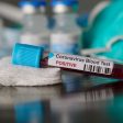 Мъж на 32 години от Смолян е заразен с коронавирус