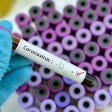 Само 1 нов случай на коронавирус за Смолянска област