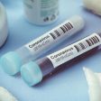 5 нови случаи на коронавирус в Смолянска област