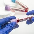 Пет нови случая на Covid-19 в Смолянско