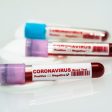 22 са вече оздравелите от коронавирус в област Смолян